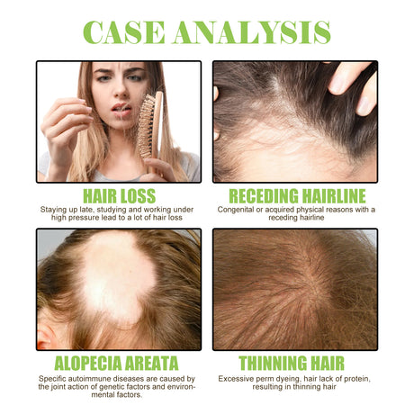 Ginger Care Shampoo Scalp Cleansing, Anti-Break Nourishing Root Strengthening Shampoo - V.I.P Digital Presence