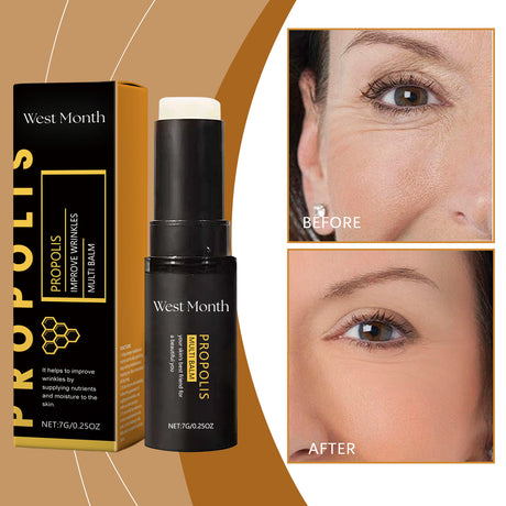 Propolis Firming And Anti-Wrinkle Moisturizing Bar, Moisturizing And Repairing Face Gentle Nourishing Skin Bar - V.I.P Digital Presence