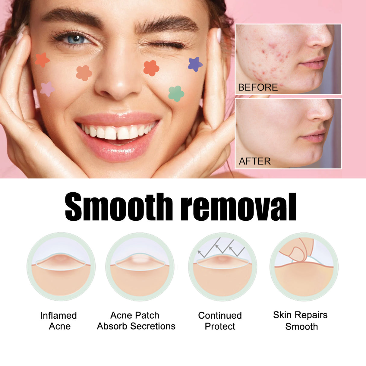 Acne Removal Protection Defense Patch, Color Profile-shaped Portable Invisible Cover Acne Patch - V.I.P Digital Presence