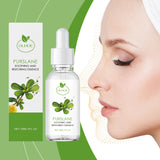 Purslane Soothing Repair Serum Redness Soothing Facial Hydrating Moisturizing Serum
