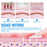 Men's Skin Care Cream For Inner Thigh Itching Relief Refreshing And Gentle Skin Cream - V.I.P Digital Presence