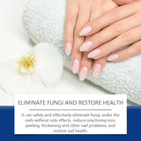 Nail Repair Machine Daily Gentle Care Of Hand And Foot Nails Cleaning And Repairing Damaged Nails Moisturizing Care Machine