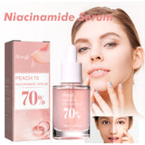 Nicotinamide Essence Tights And Moisturizes Pores, Lighens Acne Marks And Spots, Moisturizes And Brighens Skin - V.I.P Digital Presence