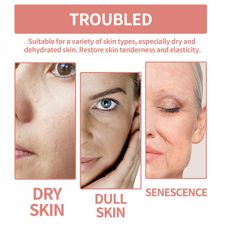 Squalane Vc Rose Moisturizing Cream, Anti Dull Moisturizing Firming Brightening Face Cream - V.I.P Digital Presence