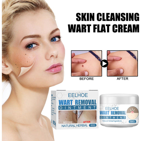 Wart Cream, Skin Clean And Smooth Wart Nevi Facial Care Cream - V.I.P Digital Presence