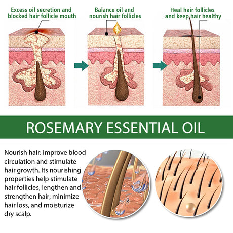 Multi-Effect Rosemary Essential Oil, Strengthens Hair Moisturizes And Thickens Hair And Skin Care Multi-effect Essential Oil - V.I.P Digital Presence