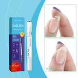 Nail Repair Solution, Daily Repair And Repair Of Damaged Nails Mild Nail Polish Care Solution - V.I.P Digital Presence