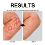 Cowhide Moss Repair Spray Relieves Redness And Itchy Scalp Skin Repair Spray - V.I.P Digital Presence