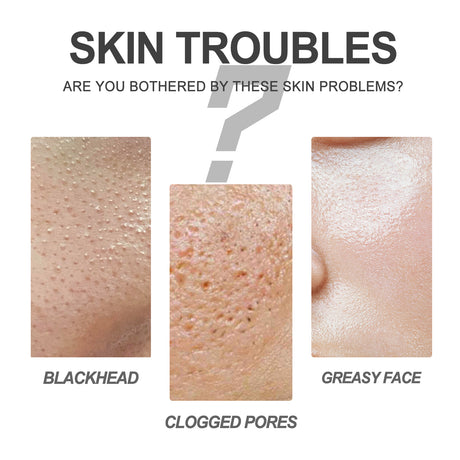 Blackhead Cleansing Cream Skin Oil Blackheads Acne Exfoliating Cleansing Repair Pore Tearing Nose Patch - V.I.P Digital Presence
