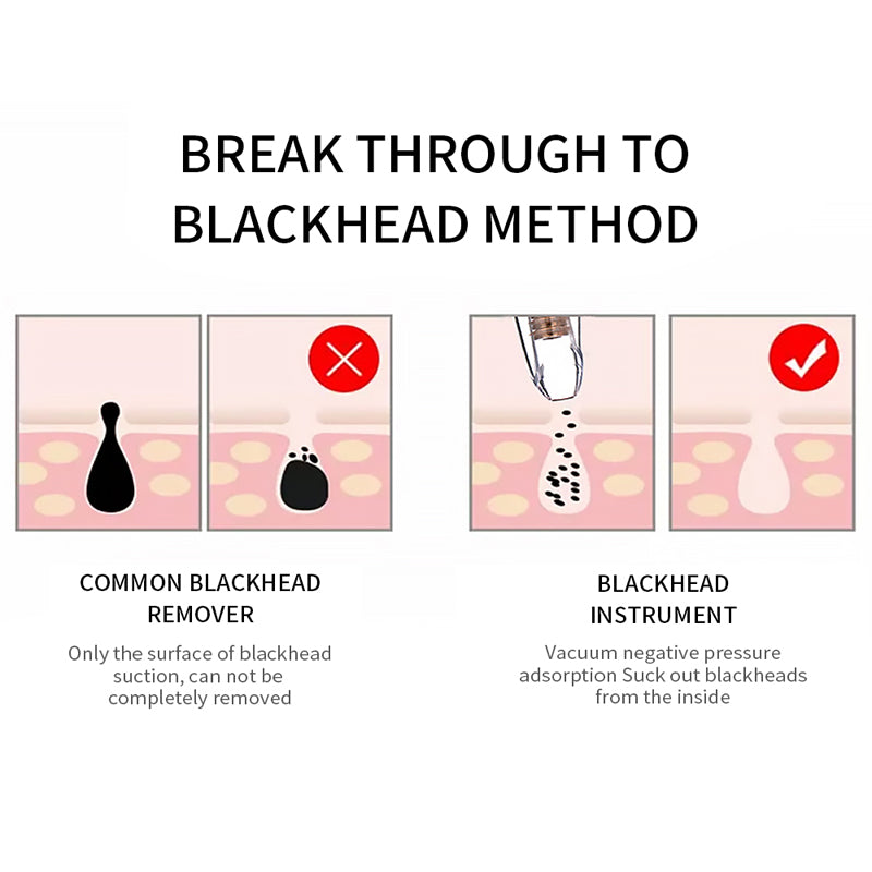 Blackhead Remover Face Deep Pore Cleaner Removal Vacuum Suction Facial SPA Diamond Beauty Care Tool Skin Care - V.I.P Digital Presence
