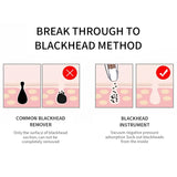 Blackhead Remover Face Deep Pore Cleaner Removal Vacuum Suction Facial SPA Diamond Beauty Care Tool Skin Care - V.I.P Digital Presence