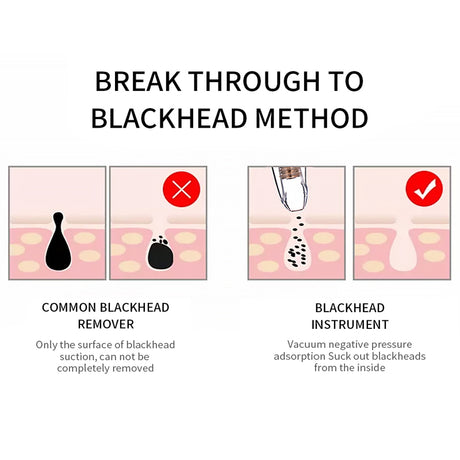 Blackhead Remover Face Deep Pore Cleaner Removal Vacuum Suction Facial SPA Diamond Beauty Care Tool Skin Care - V.I.P Digital Presence