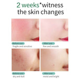 SKIN EVER Centella Repair Face Cream Moisturizing and Moisturizing Repair Facial Skin Face Cream Skin Care Product SK017 - V.I.P Digital Presence