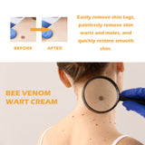 Bee Venom Wart Cream, Repair Smooth Skin Lightening Nevus Spot Nevus Cure Wart Care Cream - V.I.P Digital Presence