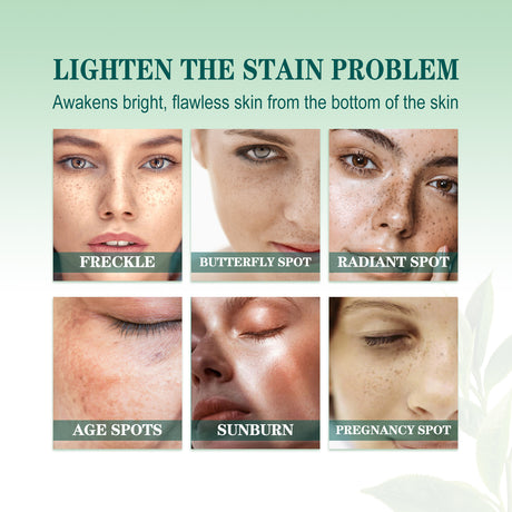 Brightening Blemish Essence, Lightening Melasma Blemish Hydrating And Brightening Skin Essence - V.I.P Digital Presence