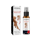 Vitiligo Removal Relief Spray, Repair Whitening Spot Perspiration Beauty Moisturizing Skin Care spray - V.I.P Digital Presence