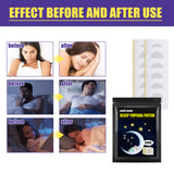 Sleep Patch Home Gentle Care To Improve Sleep Quality Daily Body Care Patch - V.I.P Digital Presence