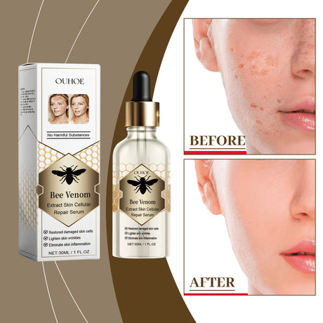 Bee Venom Skin Repair Essence, Body Skin Smoothing And Firming Gentle Moisturizing Massage Treatment Essence - V.I.P Digital Presence