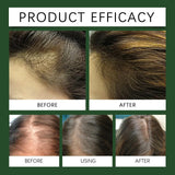 Rosemary Oil For Hair Growth, Promotes Healthy And Nourishing Strong Hair Essential Oil Hair Growth Oil - V.I.P Digital Presence