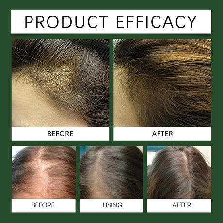 Rosemary Oil For Hair Growth, Promotes Healthy And Nourishing Strong Hair Essential Oil Hair Growth Oil - V.I.P Digital Presence