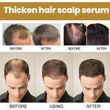 Tight Hair Shampoo Hair Cleansing Massage Scalp To Prevent Loose Tight Hair Roots Strong And Solid Hair Shampoo - V.I.P Digital Presence