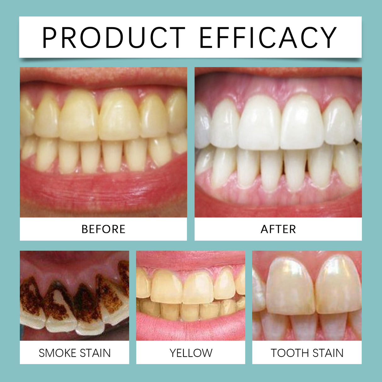 Instant Tooth Whitening Tooth Paint, Clean The Tartar Very Well Dirt Bright White Teeth And Fresh Smell - V.I.P Digital Presence