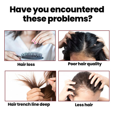 Hair Intensive Essence, Moisturizes Hair Roots, Fast Growing Prevents Loss And Strengthens Hair Care Essence - V.I.P Digital Presence