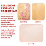 Bee-Poison Cowhide Moss Cream, Which Relieves Redness And Itchiness Of Skin - V.I.P Digital Presence