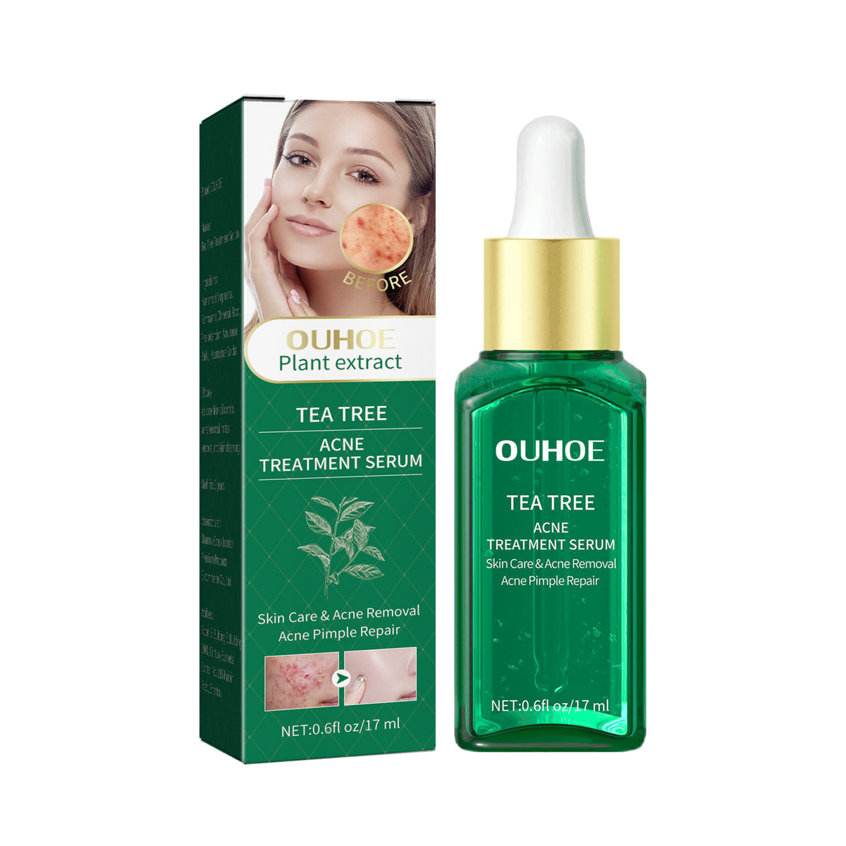 Tea Tree Oil Acne Serum, Remove Acne, Clear Acne, Repair Skin, Lighten Acne Printing Face Essence - V.I.P Digital Presence