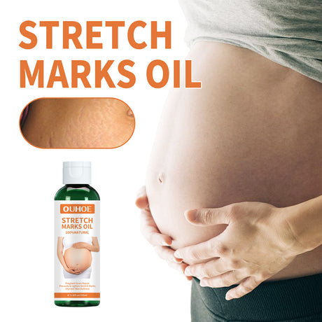 Pregnancy Massage Oil, Repair Pregnant Women Prenatal And Postpartum Stretch Mark Skin Care Massage Oil - V.I.P Digital Presence
