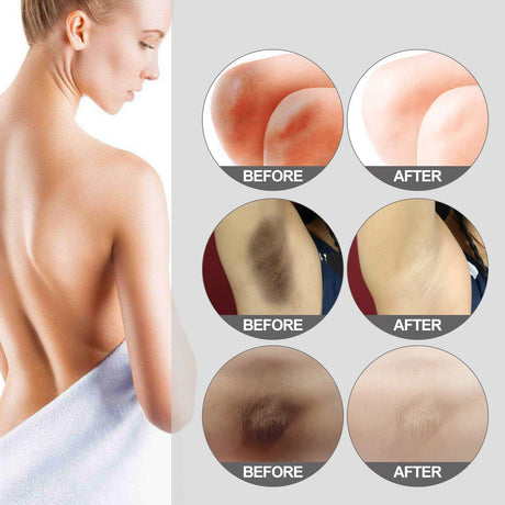 Thigh Radiance Moisturizing And Brightening Cream For Armpit Thighs And Knees - V.I.P Digital Presence