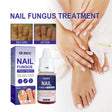 Nail Repair Lotion, Repair Thickening Nail Inlay Gray Nail Shine Soft Nail Care Solution - V.I.P Digital Presence