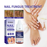 Nail Repair Lotion, Repair Thickening Nail Inlay Gray Nail Shine Soft Nail Care Solution - V.I.P Digital Presence