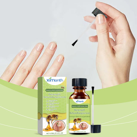 Nail Care Essence Gently Cleanses, Moisturizes And Restores Nails Daily Nail Care Essence - V.I.P Digital Presence