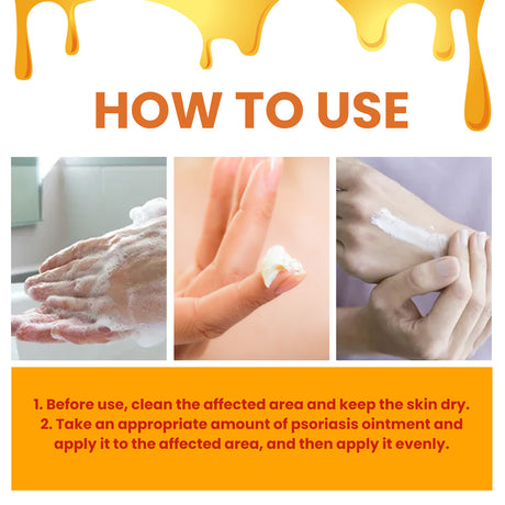 Bee-Poison Cowhide Moss Cream, Which Relieves Redness And Itchiness Of Skin - V.I.P Digital Presence