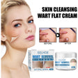 Wart Cream, Skin Clean And Smooth Wart Nevi Facial Care Cream - V.I.P Digital Presence