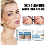 Wart Cream, Skin Clean And Smooth Wart Nevi Facial Care Cream - V.I.P Digital Presence