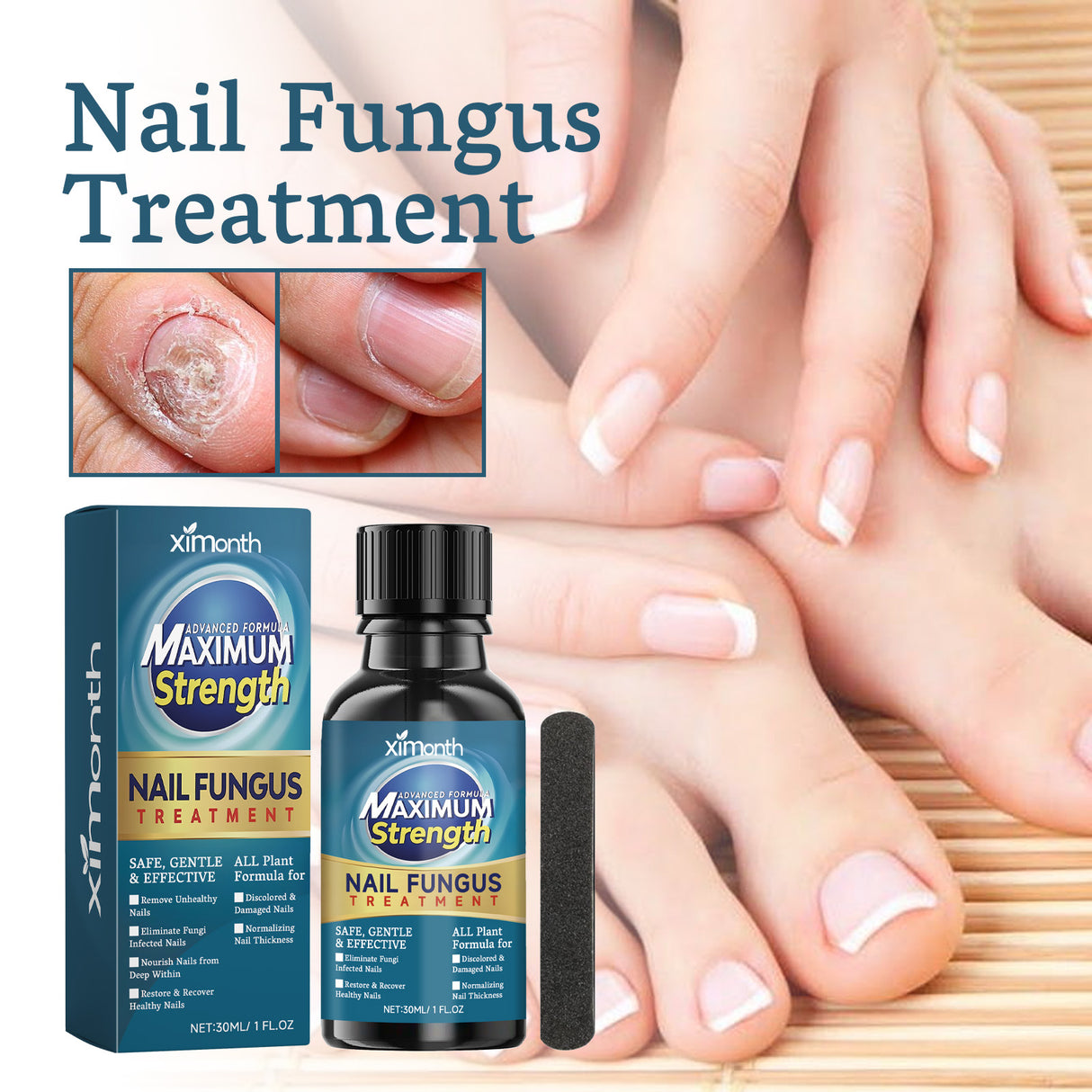 Nail Fungus Treatment, Nail Thickening Of Embedded Light Mail This Soft Armour Brothers Nails Detailer - V.I.P Digital Presence
