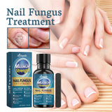 Nail Fungus Treatment, Nail Thickening Of Embedded Light Mail This Soft Armour Brothers Nails Detailer - V.I.P Digital Presence