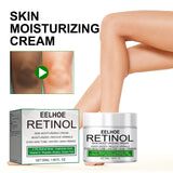 Beauty Cream Moisturizes And Nourishes Elbow Underarm Skin Brightening Skin Cream - V.I.P Digital Presence