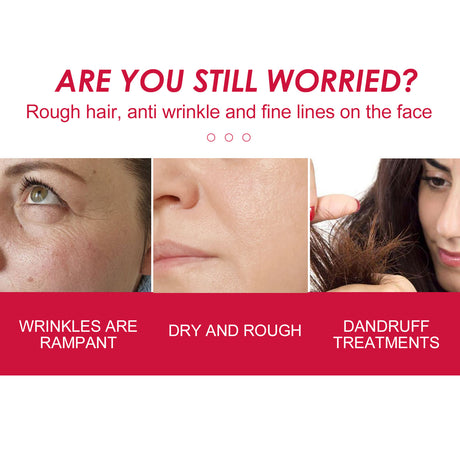 Rose Hip Facial Essential Oil Facial Body Moisturizing Skin care Supple Hair Care Massage Essential Oil - V.I.P Digital Presence