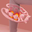Skin Tightening Roller - V.I.P Digital Presence