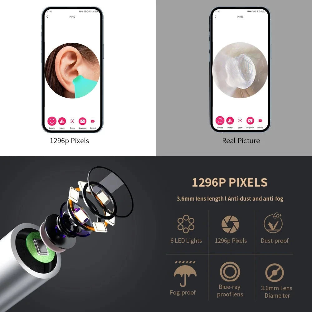 Smart Visual Earwax Cleaner - V.I.P Digital Presence